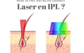 Laserontharen of IPL, wat is het verschil