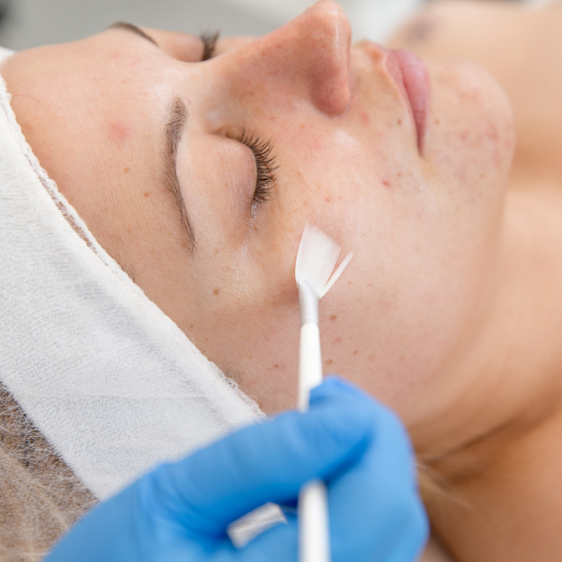 Acne-behandeling-Medical-cosmetics