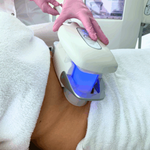 cryolipolyse-vet-bevriezen-Zoetermeer